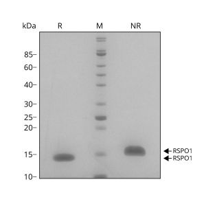 Human R-spondin 1 Qk006 protein purity SDS-PAGE lot #010