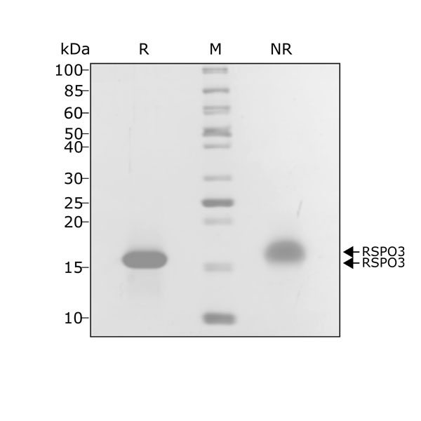 Human R-spondin 3 Qk032 protein purity SDS-PAGE lot #010