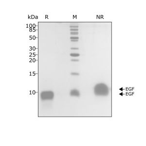 Human EGF Qk011 protein purity SDS-PAGE lot #011