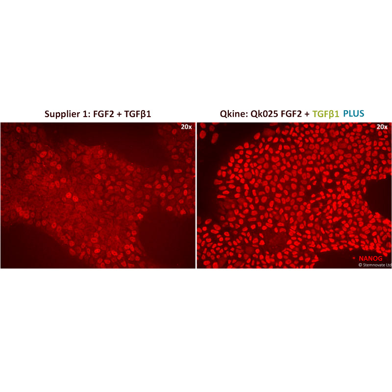 Comparison of Nanog immunofluorescence in cells maintained in TGF beta 1 from Qkine and supplier 1