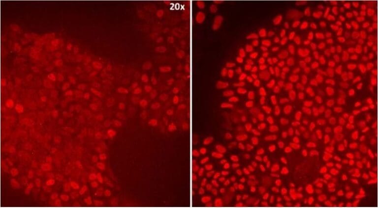 Implementing animal-free recombinant proteins into stem cell supply chains