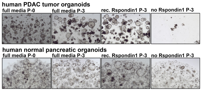 recombinant R-spondin 1 compared with conditioned media, data from Tuveson lab, CSHL