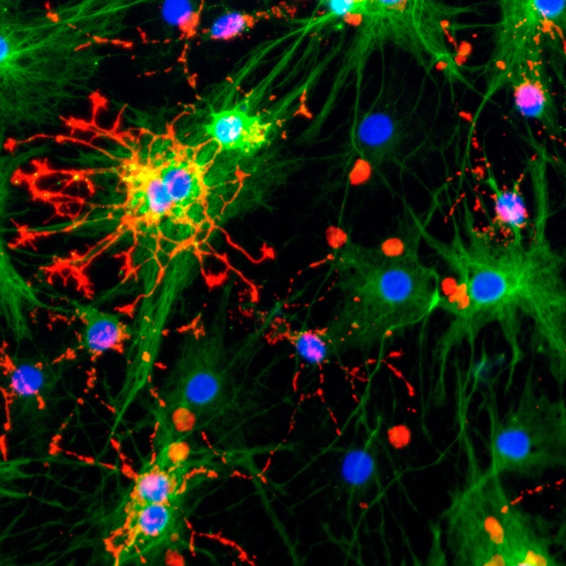 Image of neural stem cells