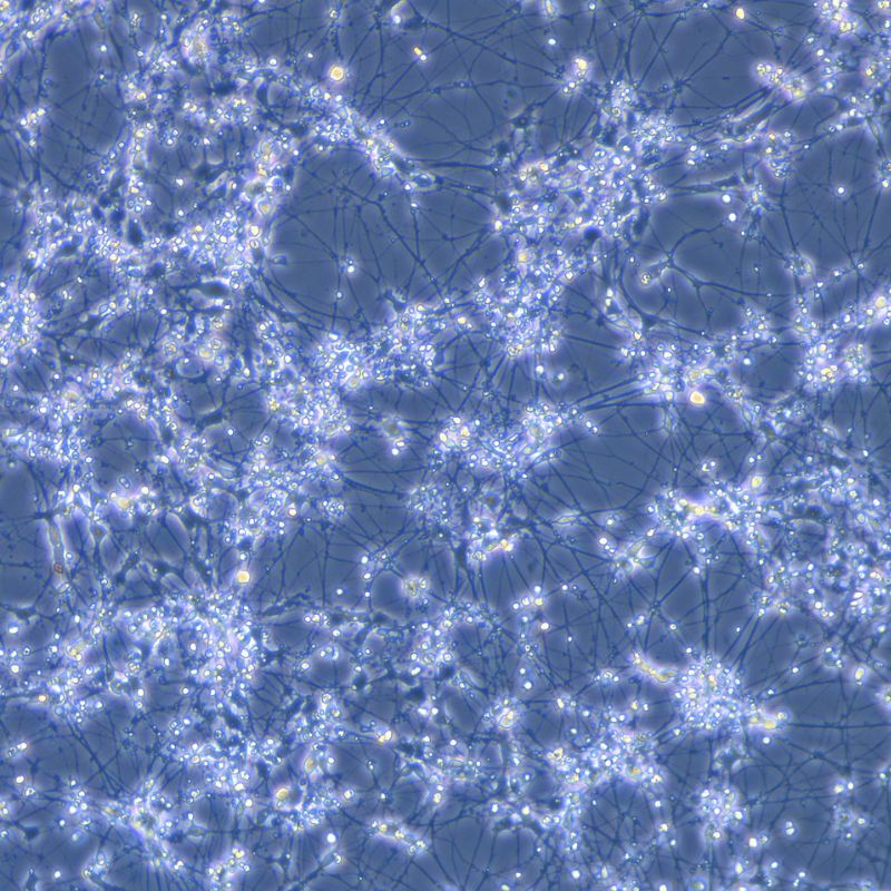 GDNF-neural-stem-cell