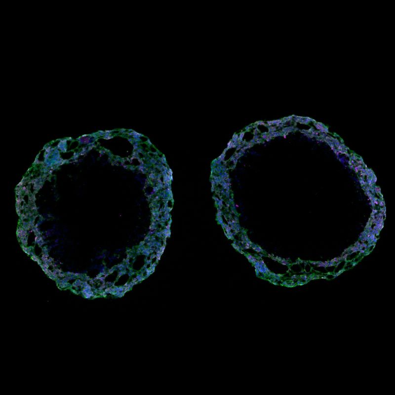 induced pluripotent stem cell organoid media recipes