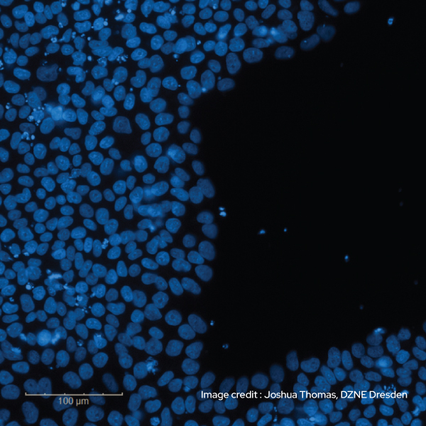 Joshua Thomas - iPSCs cultured in mTeSR™1 medium + Qkine FGF2-G3 for 3 days without a media change