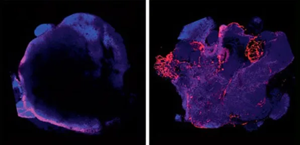 organoids-blog-h organoids-blog-h