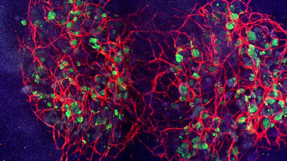 vascularized_kidney_organoids Qkine blog - Vascularized kidney organoids