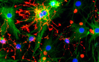 Recombinant proteins for neural stem cell culture