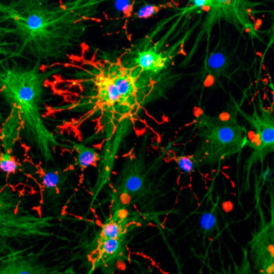 Qkine neural stem cell culture area