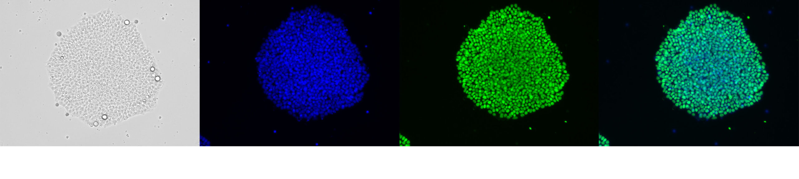 Qkine-StemCultures iPSC culture using Qkine FGF-2 145aa stained with pluripotency markers SOX2