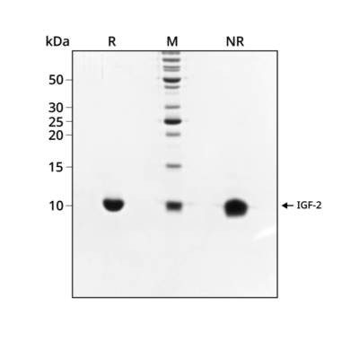 Human LIF Qk036 protein purity SDS-PAGE lot #14293