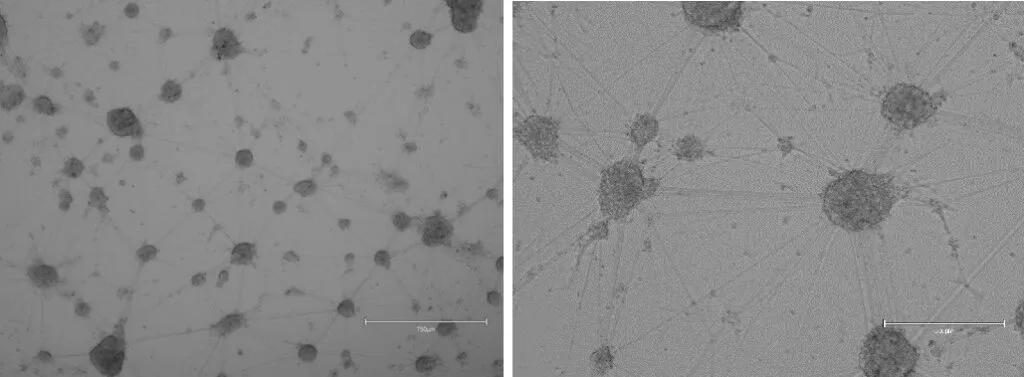Dopaminergic neurons