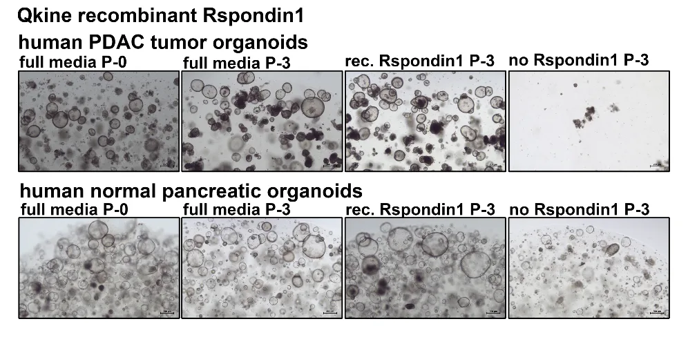 R-spondin 1 organoid images
