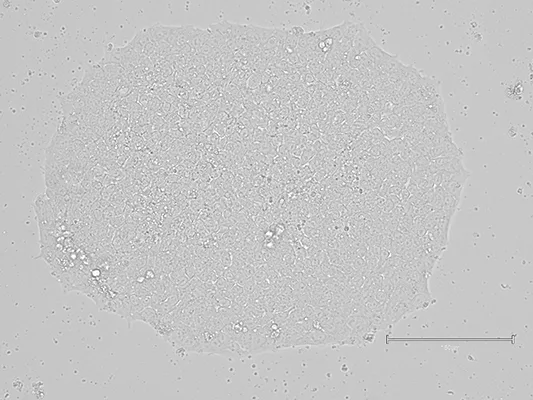 Qk120 human vitronectin maintenance of iPSC day 7