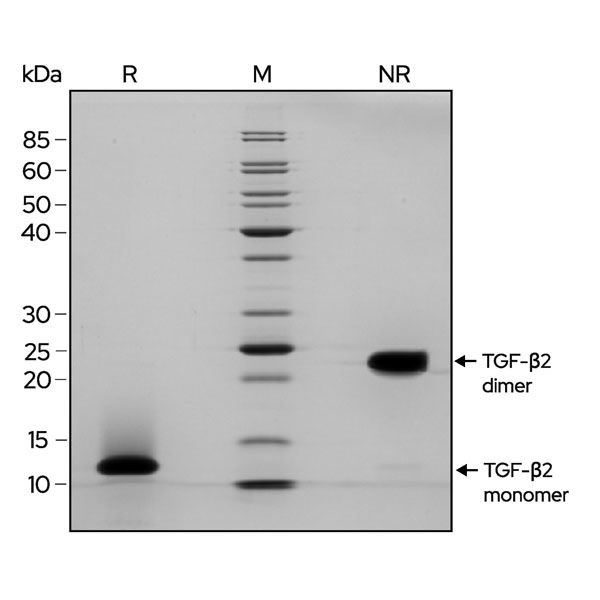 TGFb2-gel-image TGFb2-gel-image