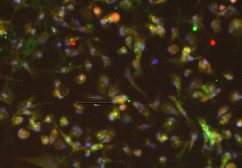 Microglia staining 800x555 Staining of microglial markers after differentiation from iPSC with Qkine IL-34 PLUS